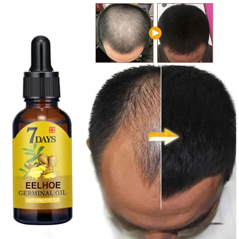 Hair Growth Serum Anti-loss Hair For Women Men