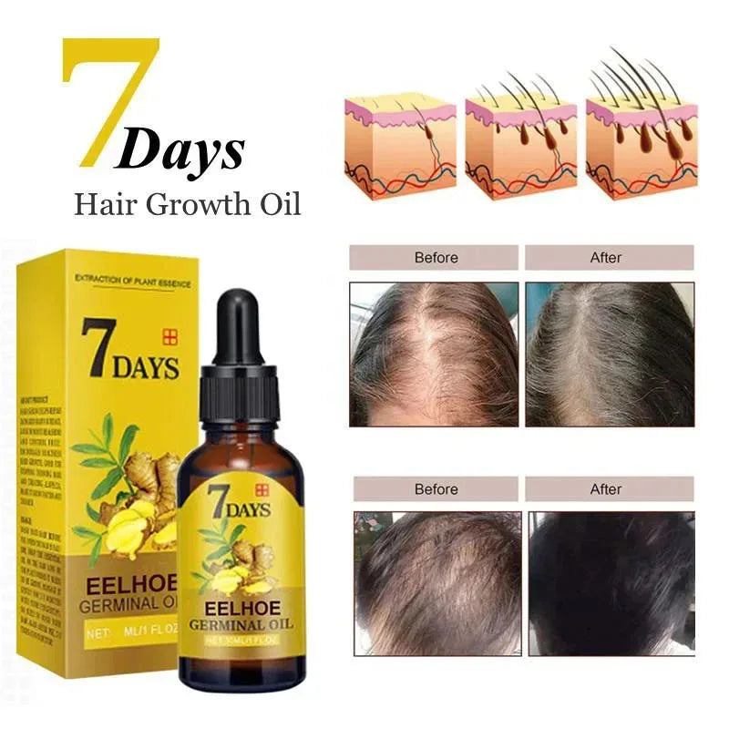 Hair Growth Serum Anti-loss Hair For Women Men