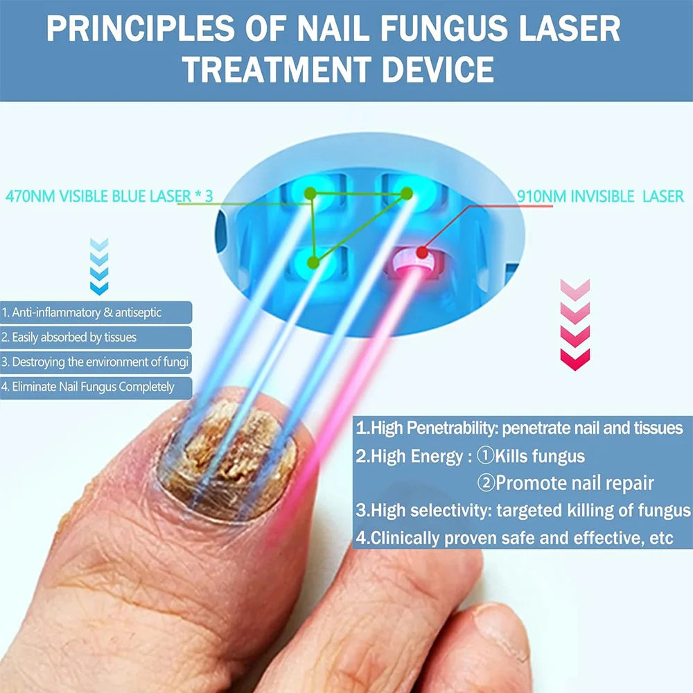 Nail Fungus Laser Treatment Device Repair Toenail Fingernail Fungus