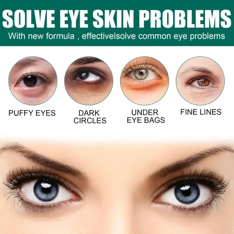 Wrinkles Eye Cream Anti Dark Circles Bags Puffiness Fade Eye